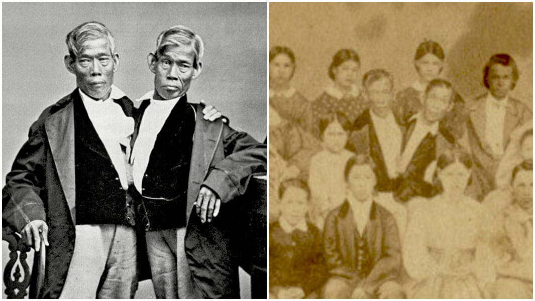 Чан і Енг Бункер, сіамські близнюки